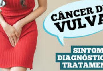 Já ouviu falar de câncer de vulva? Caroço, coceira e feridas podem ser sintomas