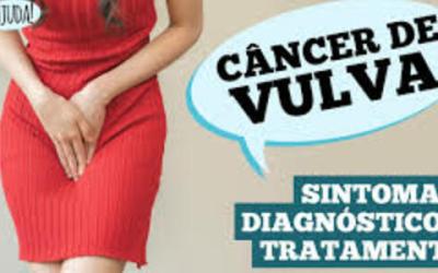 Já ouviu falar de câncer de vulva? Caroço, coceira e feridas podem ser sintomas